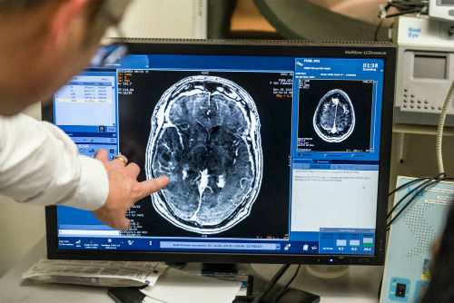 врач смотрить снимки мрт головного мозга
