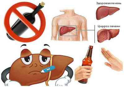 Алкогольный гепатит