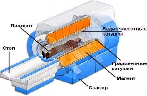 какое мрт лучше сделать для головного мозга