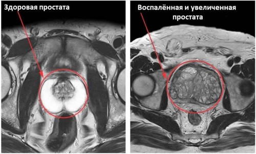 Мрт простаты с контрастированием что показывает. Смотреть фото Мрт простаты с контрастированием что показывает. Смотреть картинку Мрт простаты с контрастированием что показывает. Картинка про Мрт простаты с контрастированием что показывает. Фото Мрт простаты с контрастированием что показывает