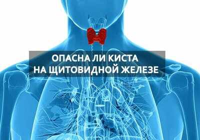 Узлы и кисты щитовидной железы